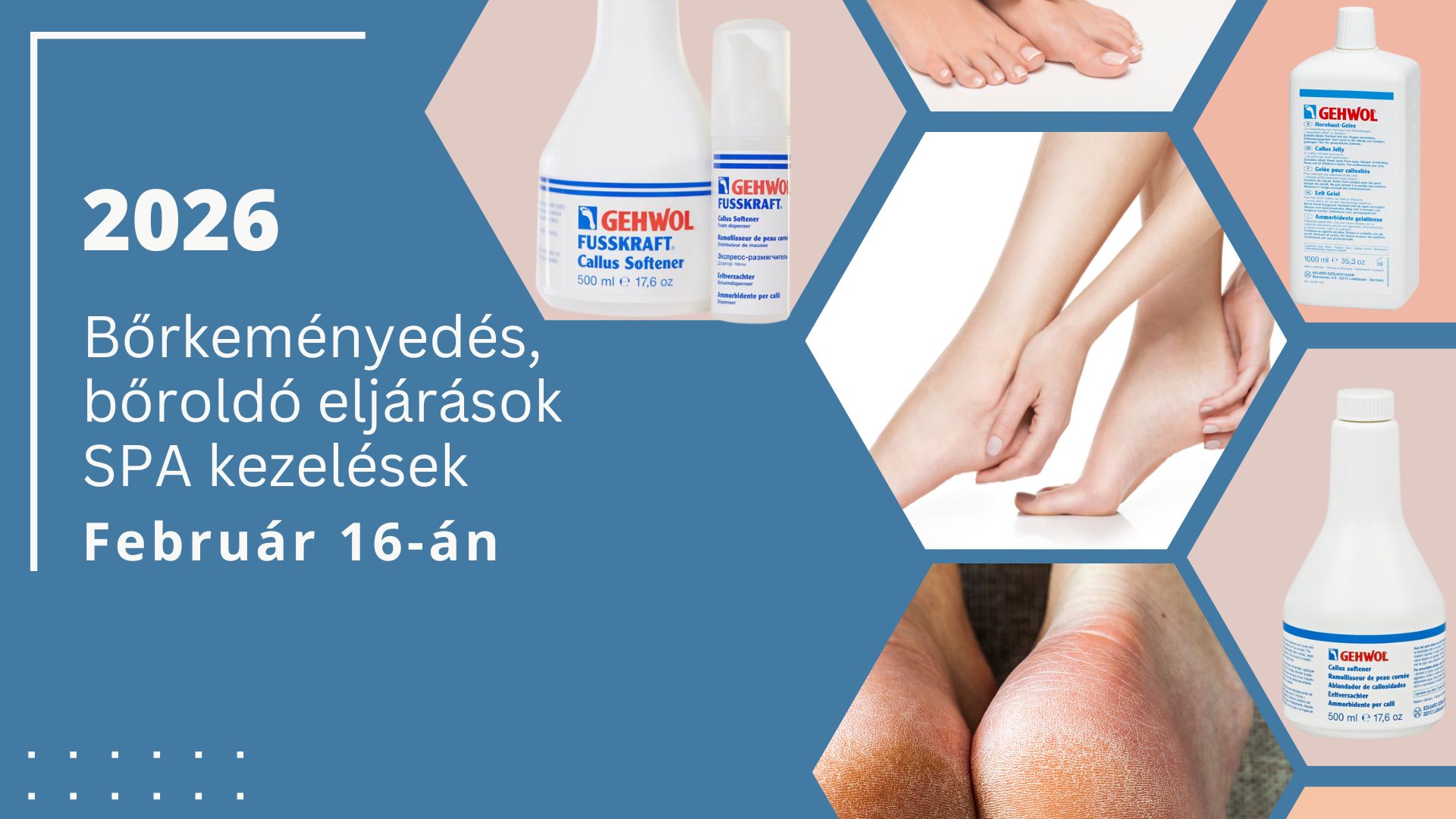 Bőrkeményedés, bőroldó eljárások SPA kezelések