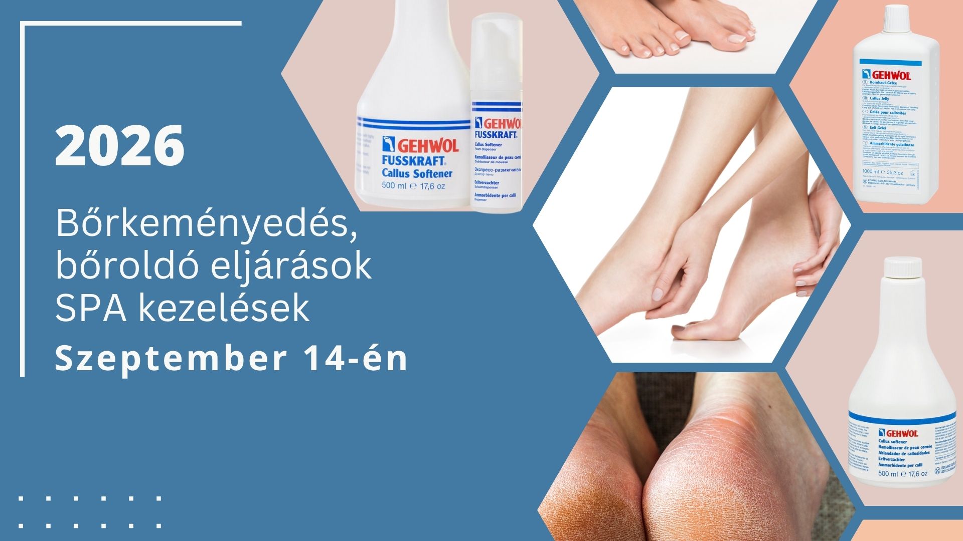 Bőrkeményedés, bőroldó eljárások SPA kezelések